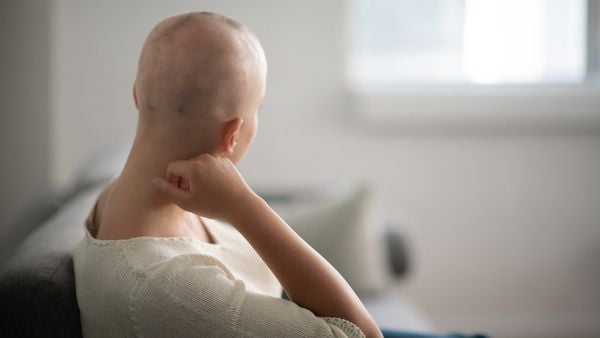 Hóa trị và xạ trị liều cao sẽ khiến tóc rụng và có thể không mọc lại