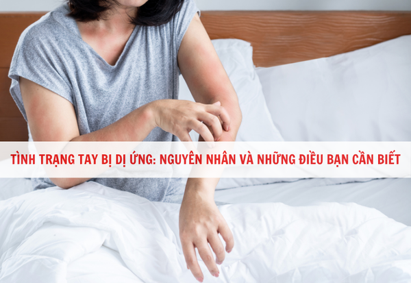 tay bị dị ứng