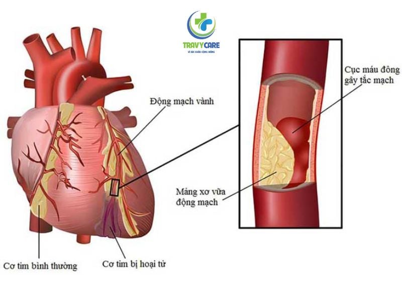 Top 5 bác sĩ tim mạch Quận Tân Phú