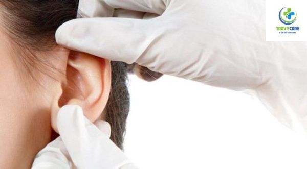 Kiểm tra tai thường xuyên để kiểm soát tốt bệnh điếc đột ngột