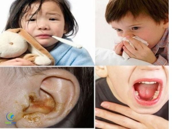 Bệnh tai mũi họng là bệnh gì