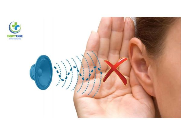 Các cấp độ của tình trạng khiếm thính