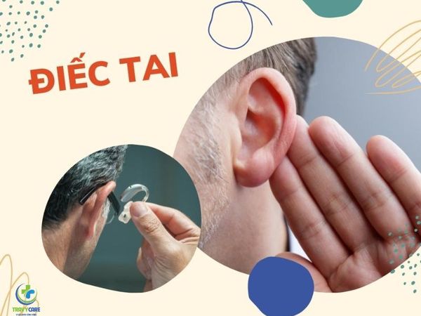 Cách chữa bệnh điếc tai hiệu quả