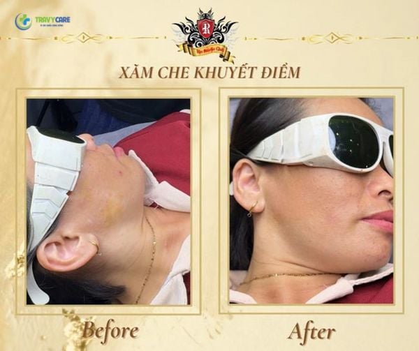 xăm màu da che khuyết điểm tại Rio Tattoo Studio