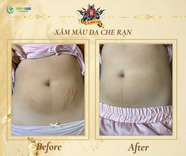 xăm màu da che rạn tại Rio Tattoo Studio