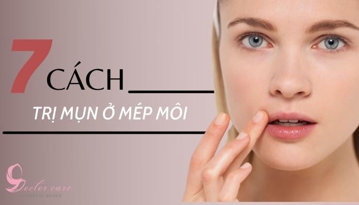 7 Cách trị mụn ở mép môi - mụn nổi quanh miệng là do đâu?