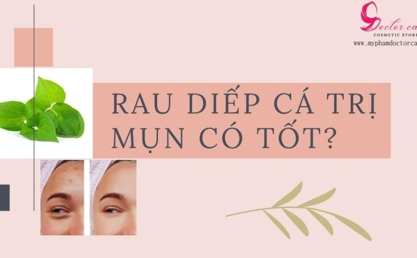 Trị mụn bằng rau diếp cá có tốt không?