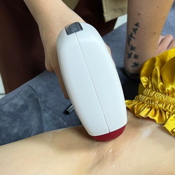 Có nên triệt lông nách không? Lợi ích của việc triệt lông nách