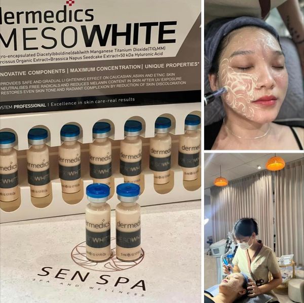 Tiêm meso căng bóng da tại Long Biên: Bí quyết làn da căng mọng, trẻ trung