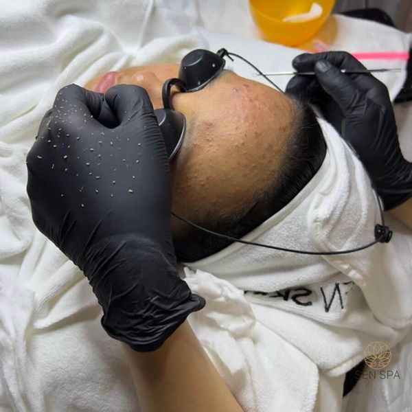 Quy trình chăm sóc da mụn hàng ngày