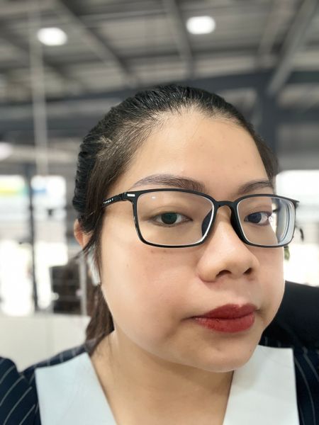 Tiêm meso căng bóng da