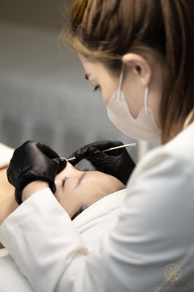 Trị mụn ở Long Biên