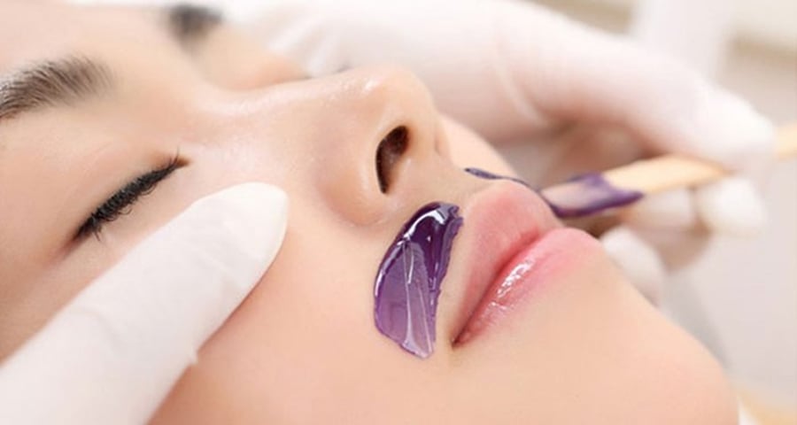 Triệt lông mép bằng sáp nóng dễ gây bỏng da