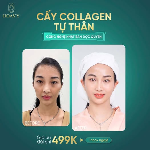 Content thẩm mỹ viện - Hoa Vy