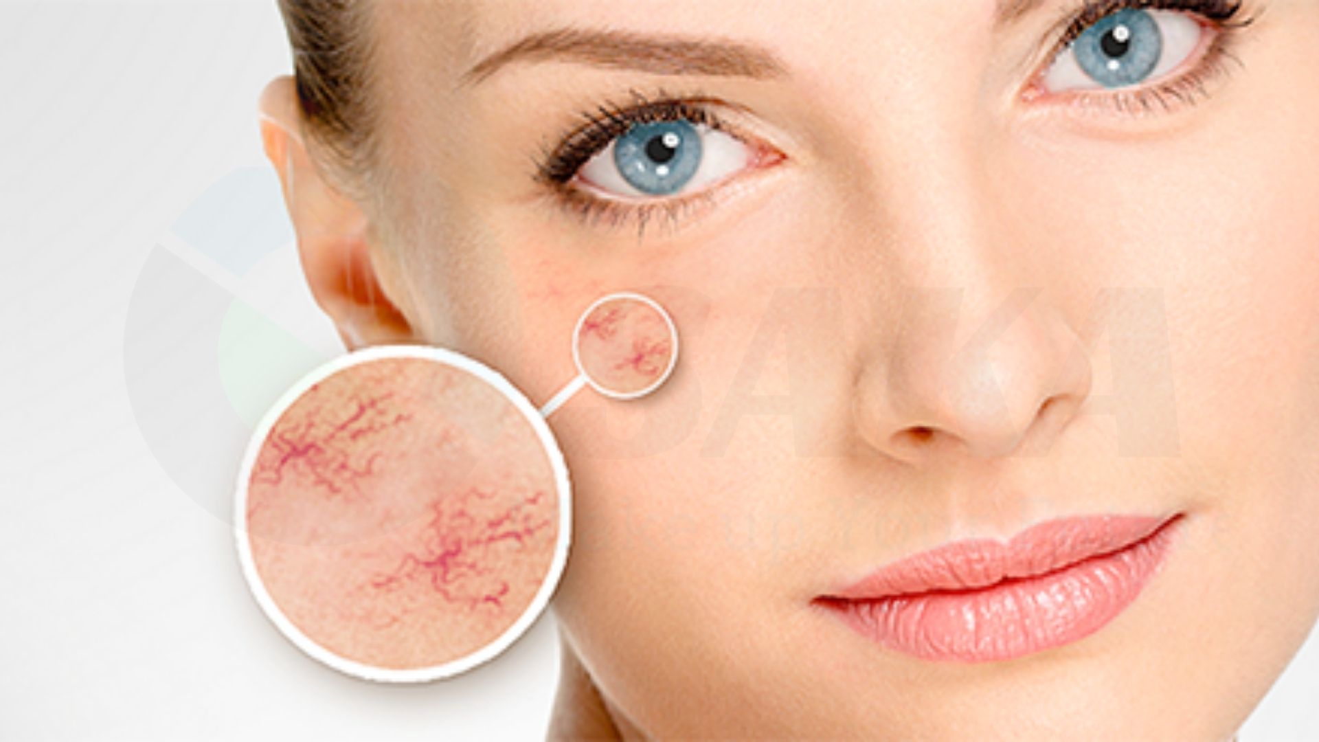 Bật mí top 2 kem phục hồi da mặt mỏng lộ mao mạch “tái sinh” làn da mới của bạn