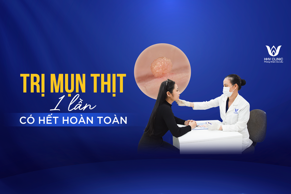 Mụn thịt điều trị một lần hết có hết hoàn toàn không?