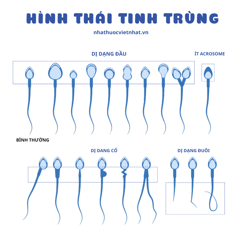 nhathuocvietnhat.vn - Các dạng bất thường phổ biến của tinh trùng