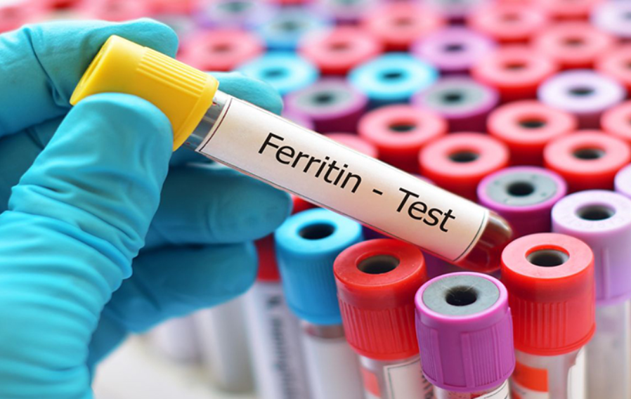 nhathuocvietnhat.vn - Xét nghiệm định lượng ferritin được thực hiện để đo lượng ferritin có trong máu, từ đó đánh giá tổng lượng sắt dự trữ trong cơ thể.