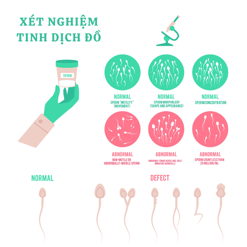 nhathuocvietnhat.vn - xét nghiệm tinh dịch đồ thể hiện các tiêu chí đánh giá chất lượng tinh trùng