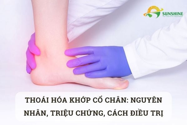 Thoái hóa khớp cổ chân: Nguyên nhân, triệu chứng, cách điều trị