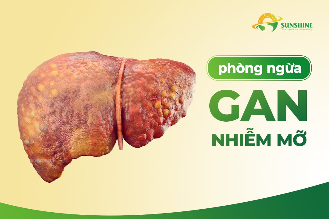 Những gì bạn cần biết về gan nhiễm mỡ tránh biến chứng nguy hiểm