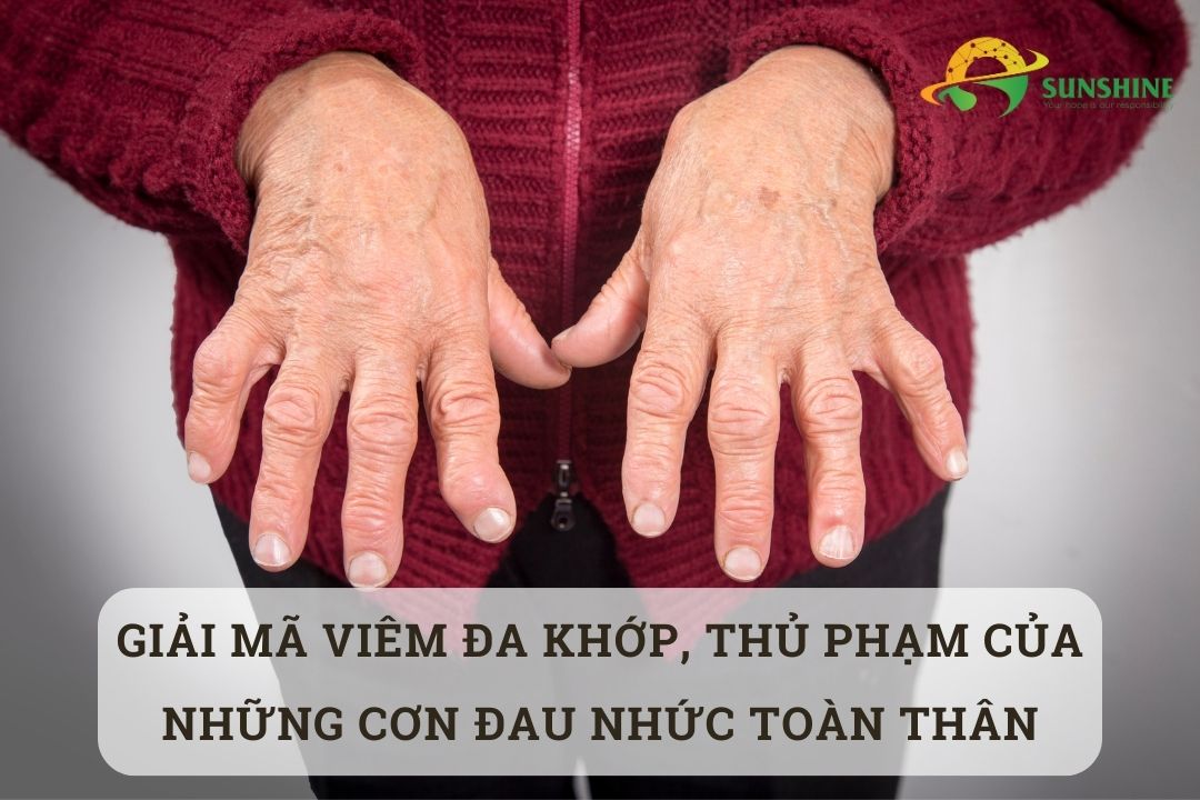 Giải mã viêm đa khớp, thủ phạm của những cơn đau nhức toàn thân