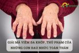 Giải mã viêm đa khớp, thủ phạm của những cơn đau nhức toàn thân