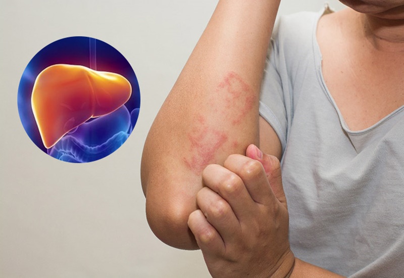 🚨 Gan nhiễm độc: Những cảnh báo