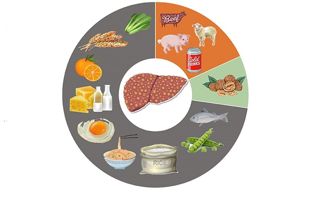 Người Bị Gan Nhiễm Mỡ Nên Tránh Gì Trong Chế Độ Ăn Uống?