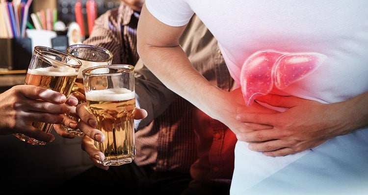 Bia Rượu ảnh hưởng Lá Gan: Hiểm Họa Thầm Lặng Bạn Không Nên Bỏ Qua