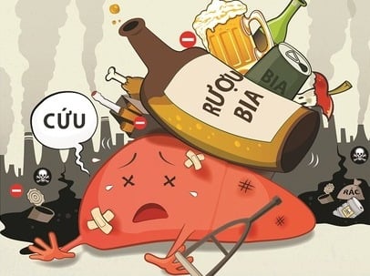 Men gan tăng cao có nguy hiểm không? Có phải dấu hiệu xơ gan, ung thư gan không?