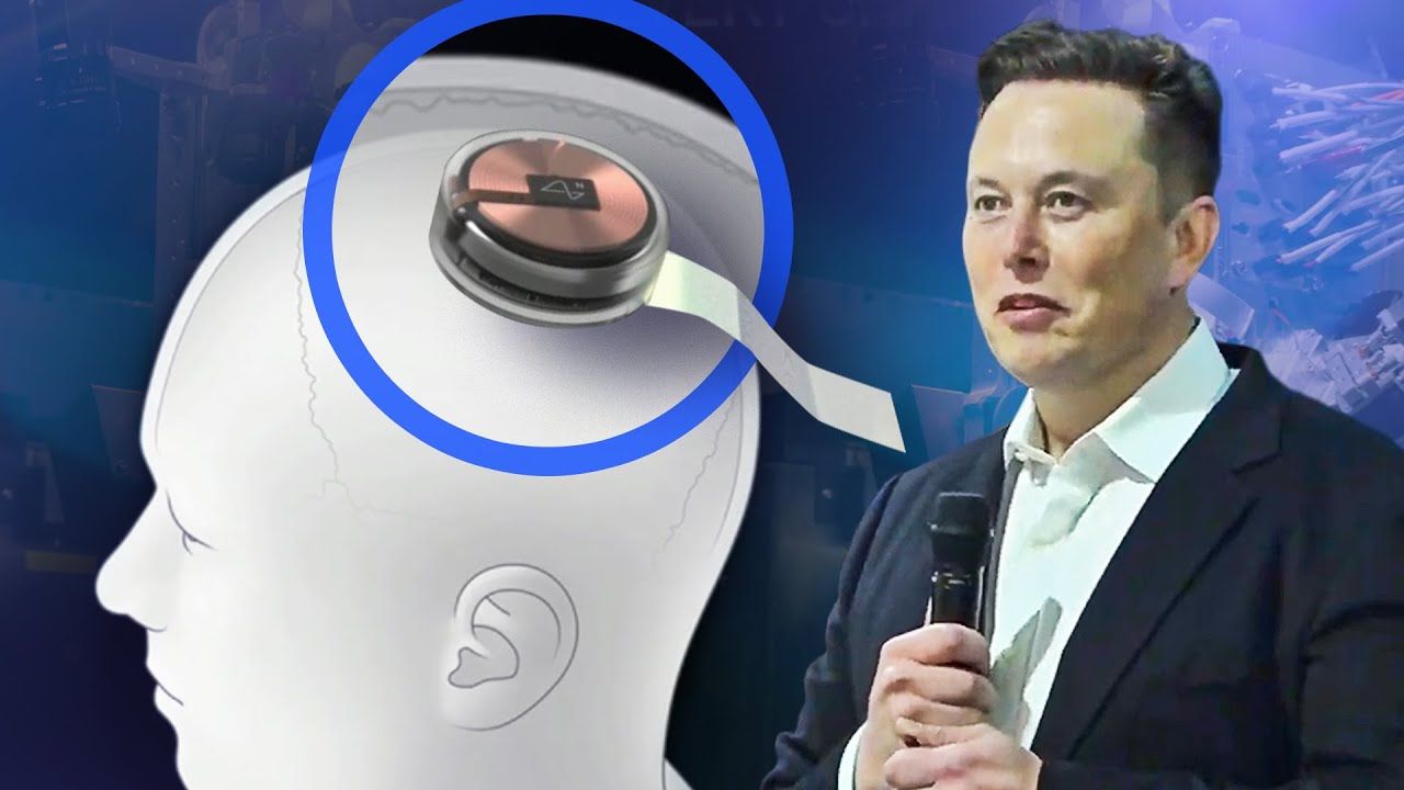 Chip cấy não của Elon Musk đã chuẩn bị thử nghiệm trên người