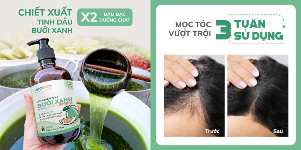 Hiệu quả mọc tóc dầu gội bưởi xanh mọc tóc Vitacare