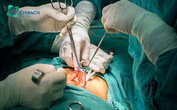 Có cần phẫu thuật khi điều trị viêm ruột thừa không?