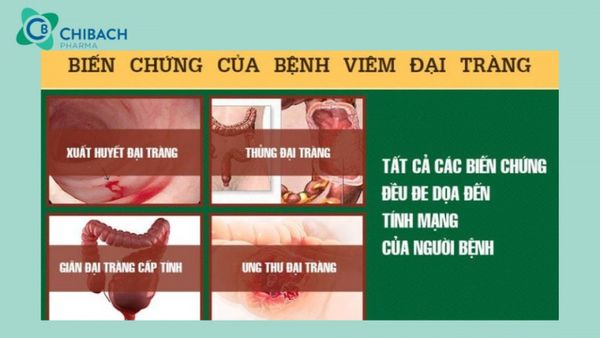 Một số biến chứng của viêm đại tràng co thắt