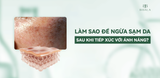 LÀM SAO ĐỂ NGỪA SẠM DA SAU KHI TIẾP XÚC VỚI ÁNH NẮNG?