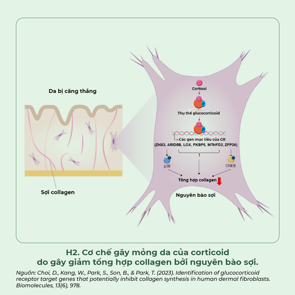 Cơ chế Corticoid gây mỏng da