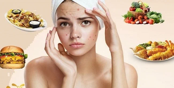 Mụn nhọt kiêng ăn gì?