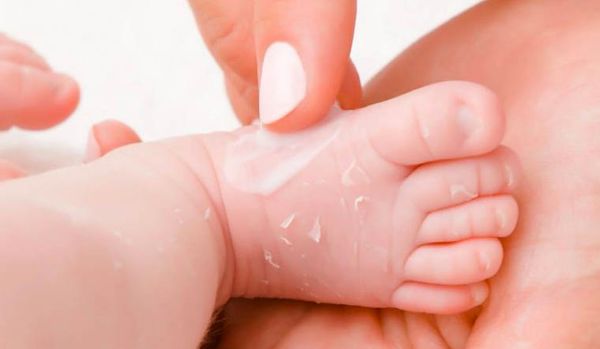 Trẻ sơ sinh bị tróc da tay chân: Nguyên nhân, cách điều trị và phòng ngừa