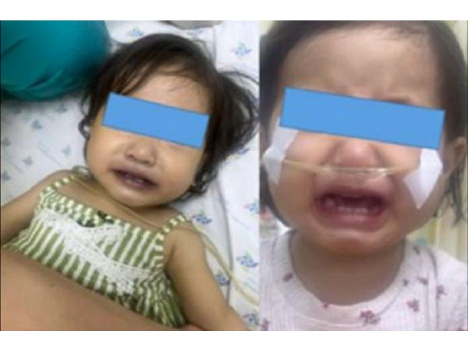 ⚠️ Cảnh báo từ thực tế: Bé gái bị tím tái do ăn cơm nấu bằng nước giếng