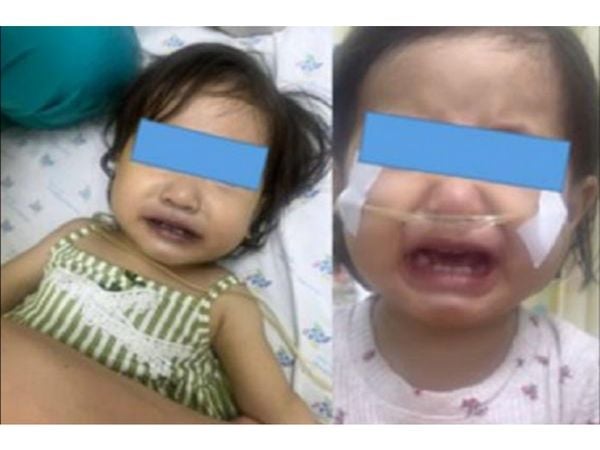 ⚠️ Cảnh báo từ thực tế: Bé gái bị tím tái do ăn cơm nấu bằng nước giếng