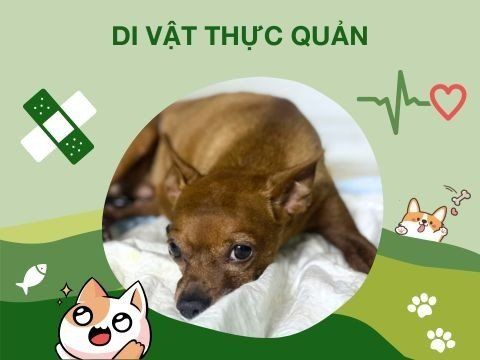 Dị vật thực quản – Phẫu thuật ngoại khoa