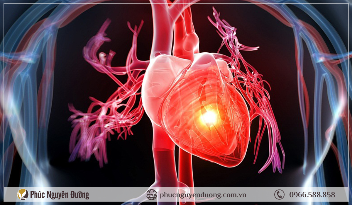 Top 5 thắc mắc thường gặp về bệnh khoa nội tim mạch