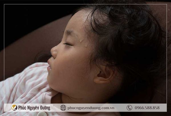 Trẻ ra mồ hôi trộm khi ngủ có đáng lo? Nguyên nhân và cách khắc phục