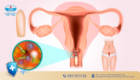 NHỮNG BỆNH PHỤ KHOA THƯỜNG GẶP Ở PHỤ NỮ — HIỂU RÕ VÀ PHÒNG TRÁNH DỄ DÀNG