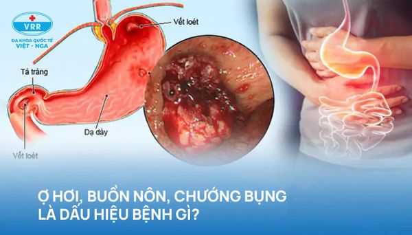 4. Phương pháp điều trị và xử lý