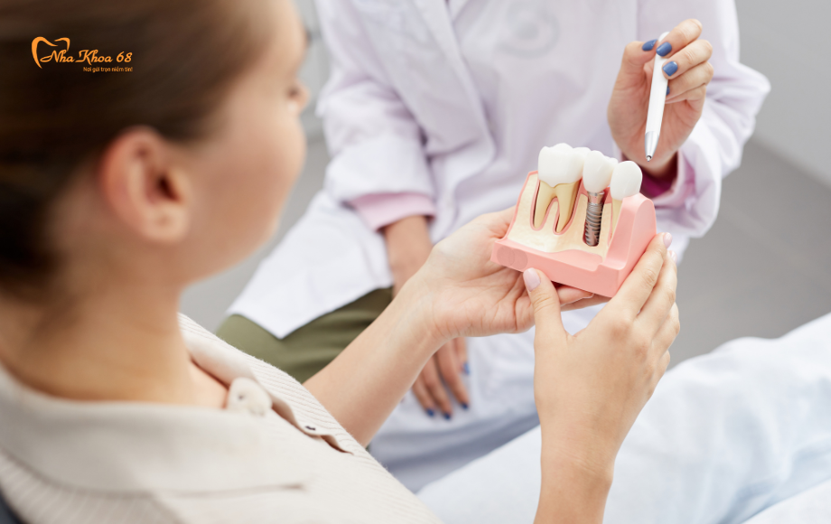 Chăm sóc tốt Implant của bạn chỉ với 4 bước !