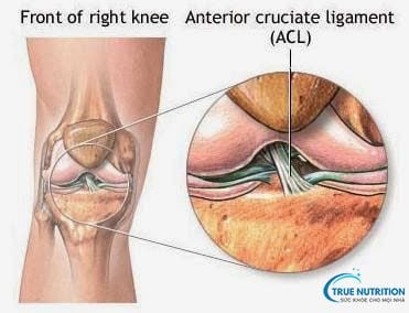 10 Điều Tránh Sau Mổ Dây Chằng Chéo: An Toàn & Mau Lành