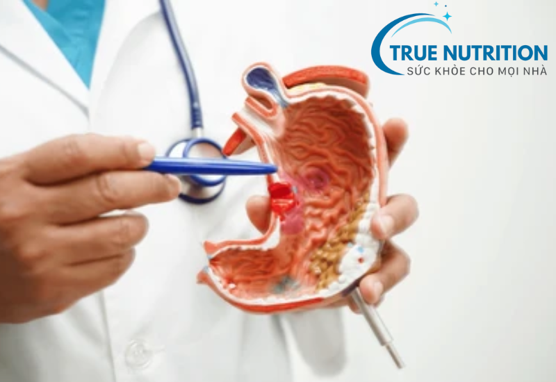 Xuất Huyết Dạ Dày Có Chữa Được Không? Chuyên Gia Giải đáp