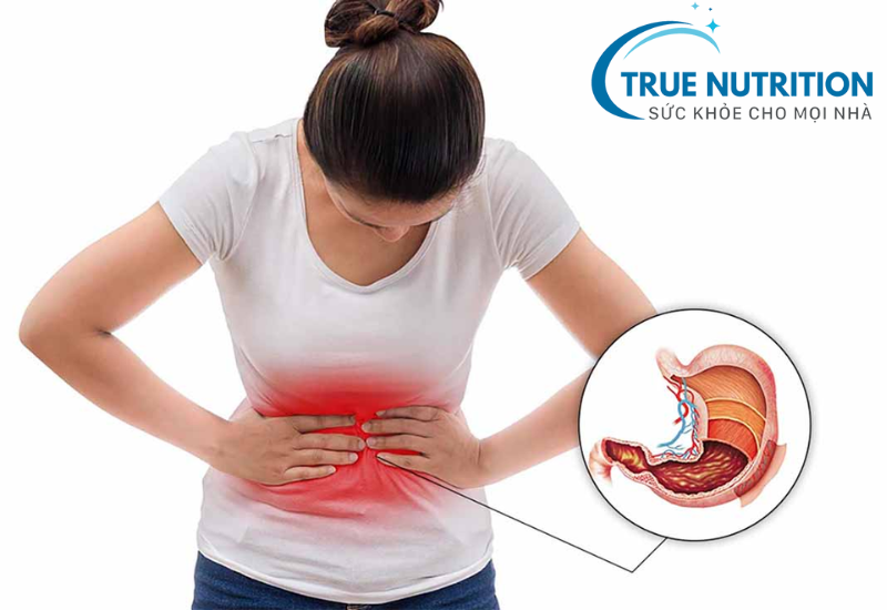 Bệnh Dạ Dày Có Di Truyền Không? Sự Thật Về Nguy Cơ Và Cách Phòng Ngừa